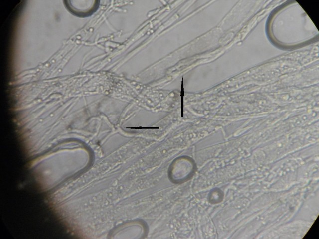 Рис. 5. Гифы T. longibrachiatum GF 2/6 (указано стрелками), проникшие в гифы мицелия фитопатогенного микромицета Rhizoctonia solani (ув. ×1600)