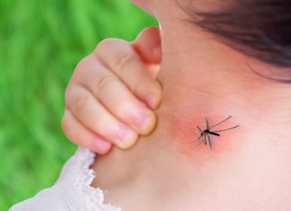 Как избавить детей от комаров и зуда после укусов?